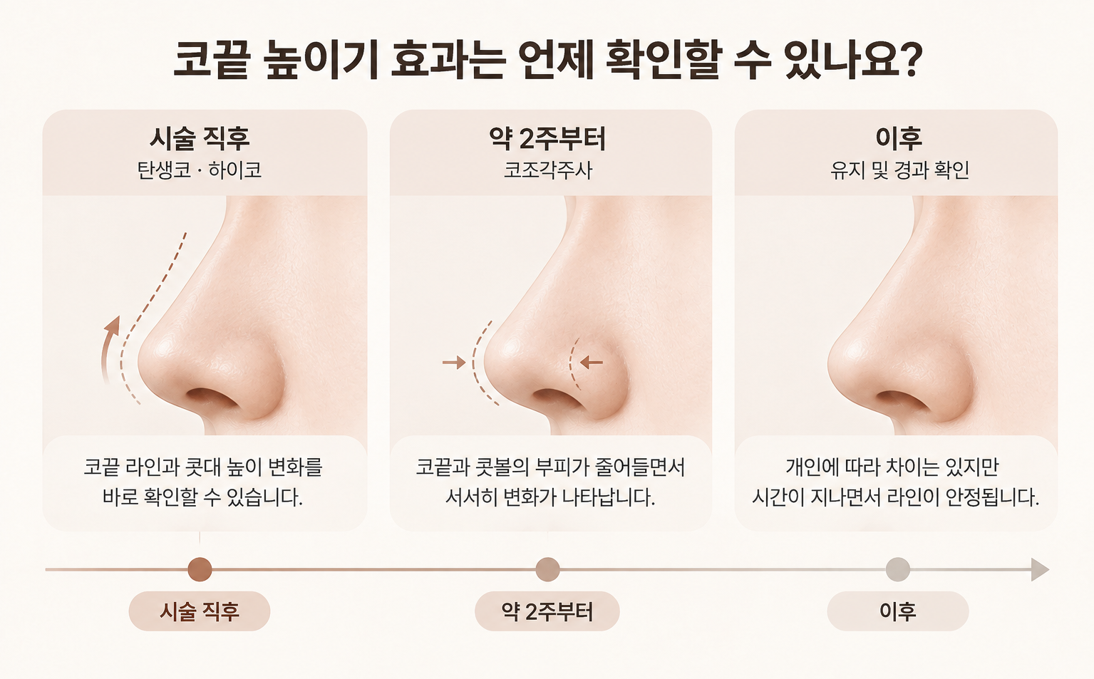 코끝 높이기 효과 시점을 탄생코와 하이코 시술 직후, 코조각주사 약 2주부터로 정리한 타임라인