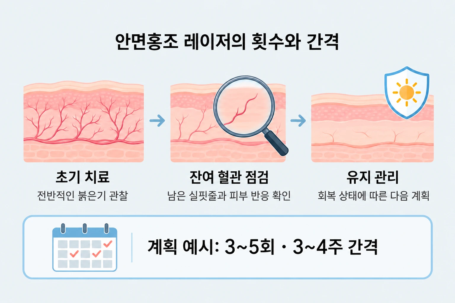 초기 치료와 잔여 혈관 점검, 유지 관리로 이어지는 안면홍조 치료 계획