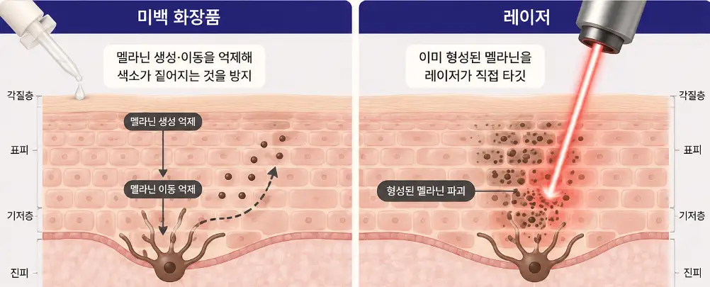 미백 화장품과 레이저의 색소 개선 원리 차이