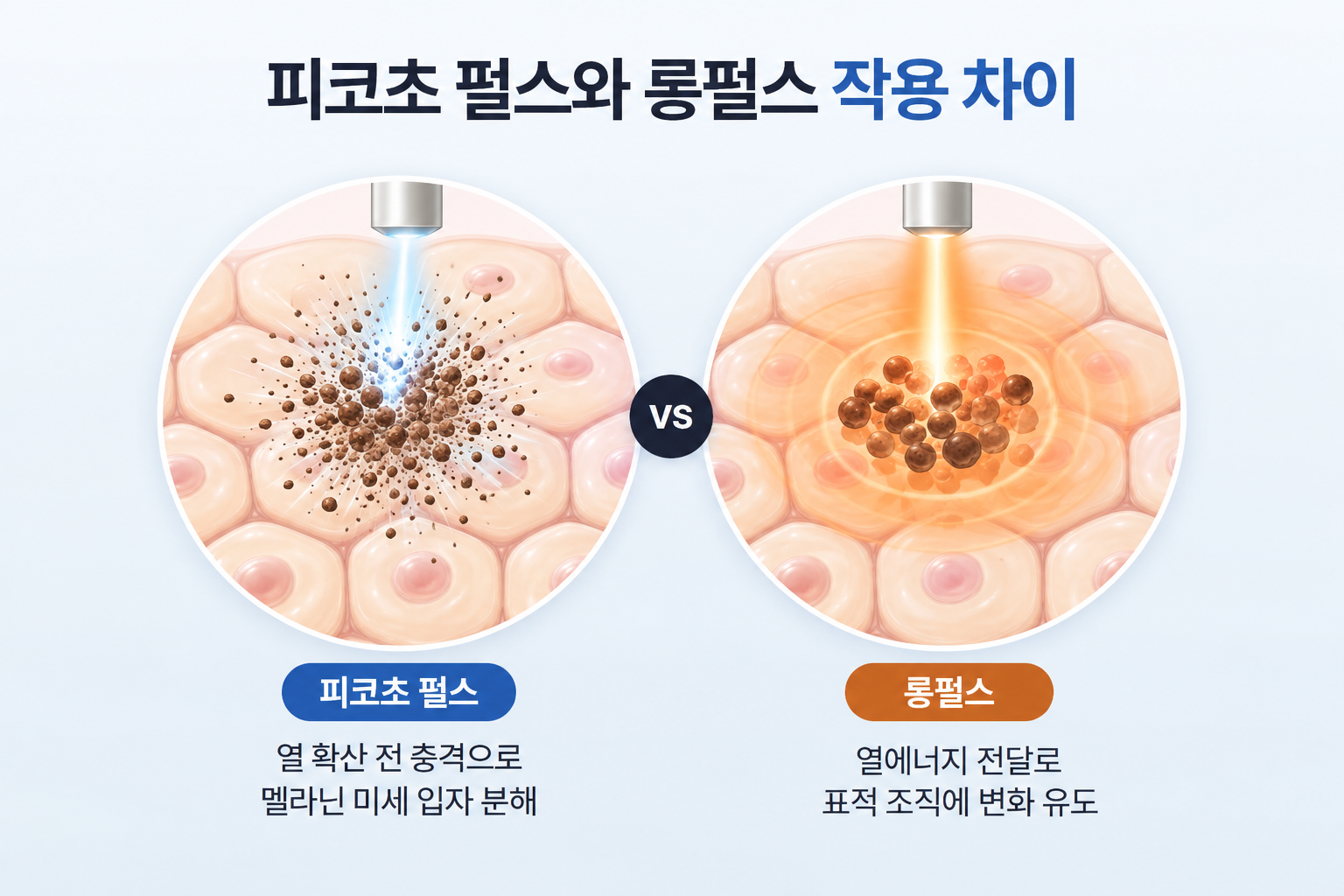 피코초 레이저가 멜라닌 색소를 미세한 입자로 분해하는 과정과 롱펄스 레이저가 열에너지로 표적 색소 조직에 작용하는 원리 비교