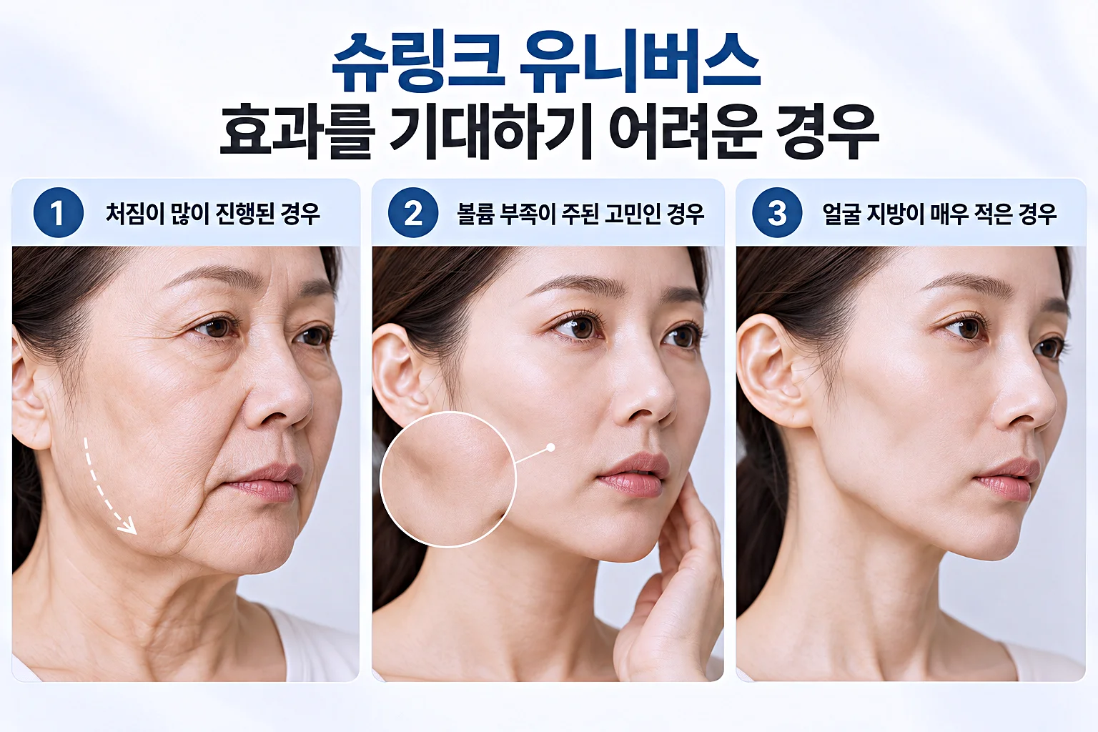 슈링크 유니버스 효과 기대하기 어려운 경우 세 가지 - 처짐, 볼륨 부족, 지방량 적음