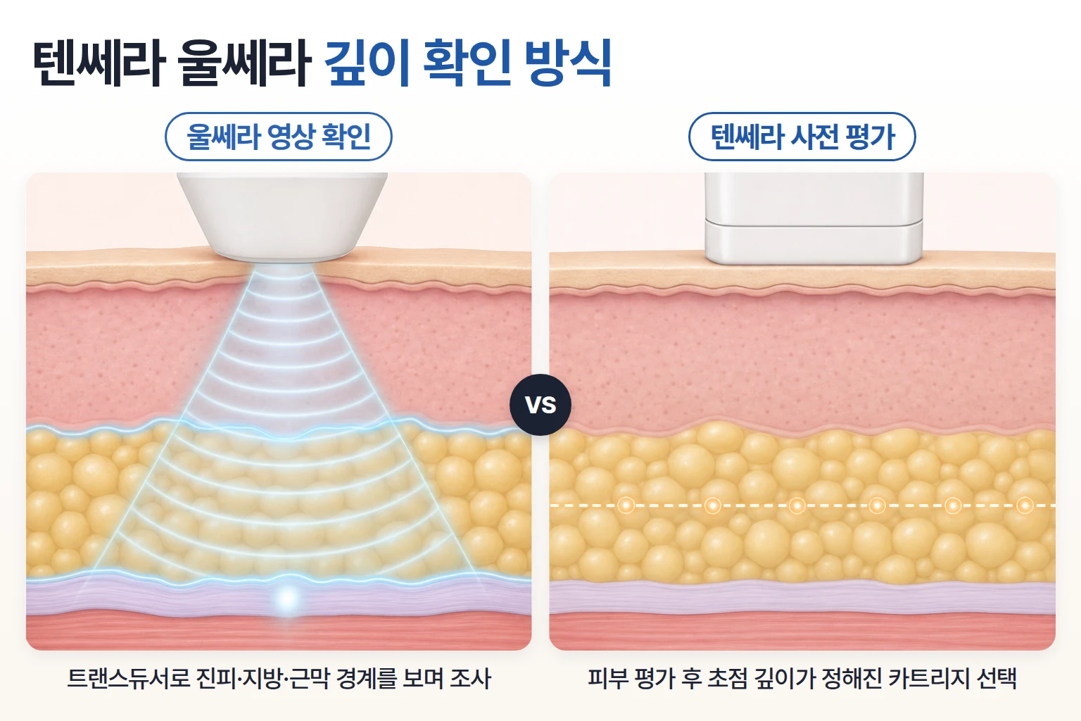 울쎄라 영상으로 진피, 지방, 근막 경계를 확인하는 방식과 텐쎄라 카트리지 깊이 선택을 비교한 도식