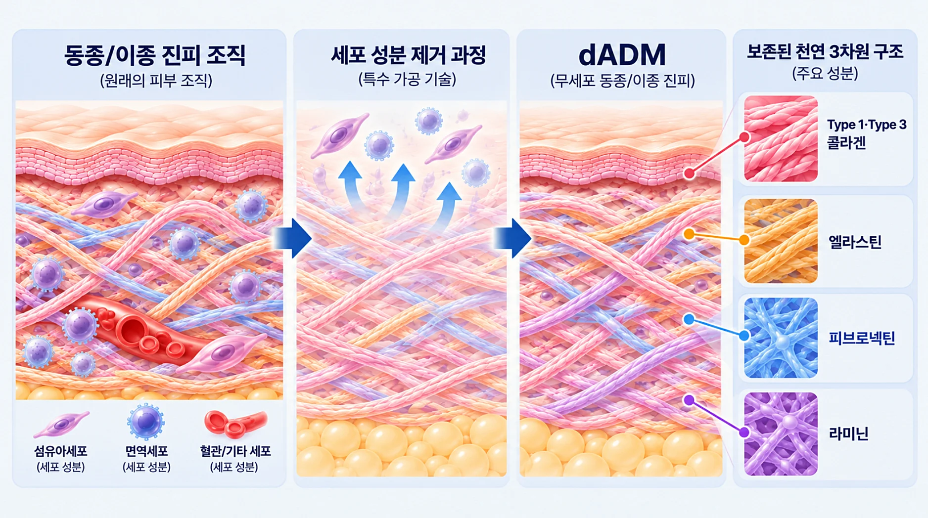 dADM 스킨부스터 성분의 Type1, Type 3 콜라겐 엘라스틴 피브로넥틴 라미닌 등의 천연 3차원 구조