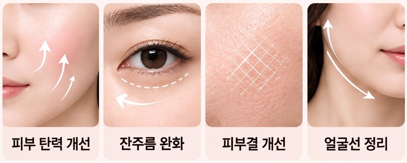 티타늄리프팅으로 기대할 수 있는 피부 탄력, 잔주름, 피부결, 얼굴선 변화를 나타낸 비교 이미지