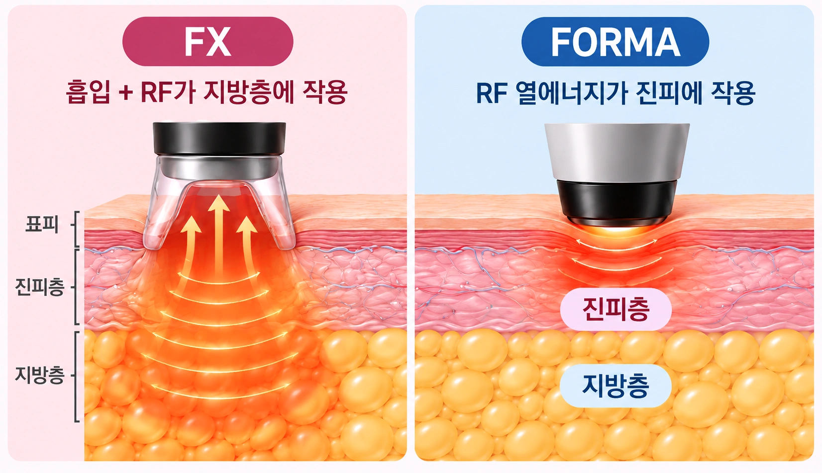 FX와 FORMA의 작용 층으로 살펴보는 바디 인모드 원리