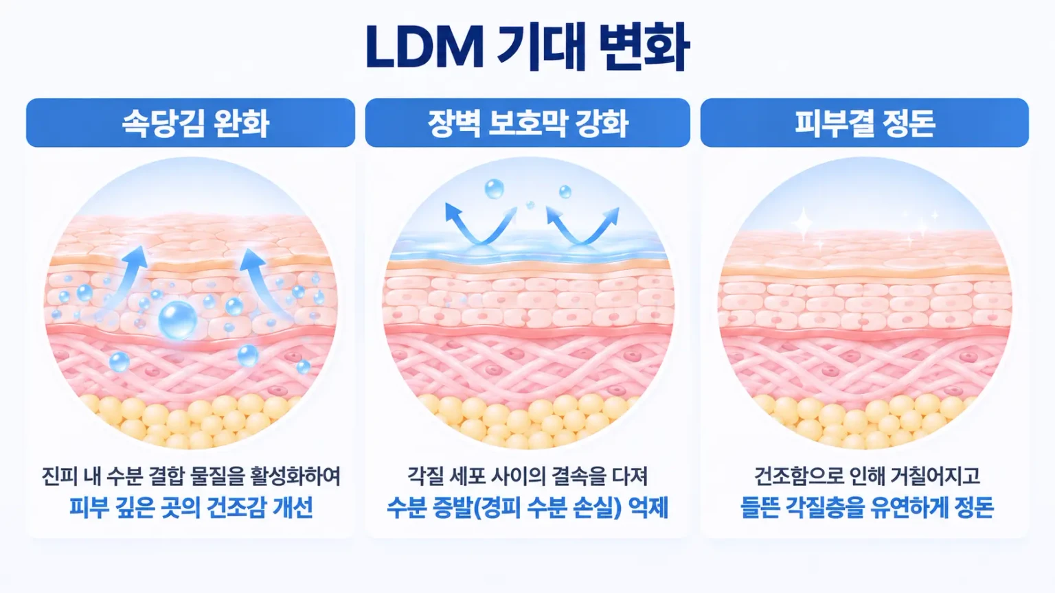 LDM 초음파 관리의 속당김 완화와 피부 장벽 및 피부결 관리 설명 이미지