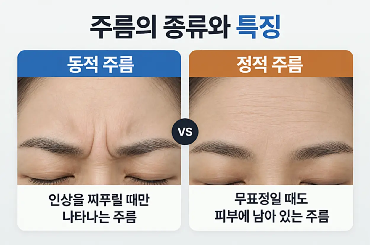 미간주름 종류 동적 주름과 정적 주름을 비교하는 이미지