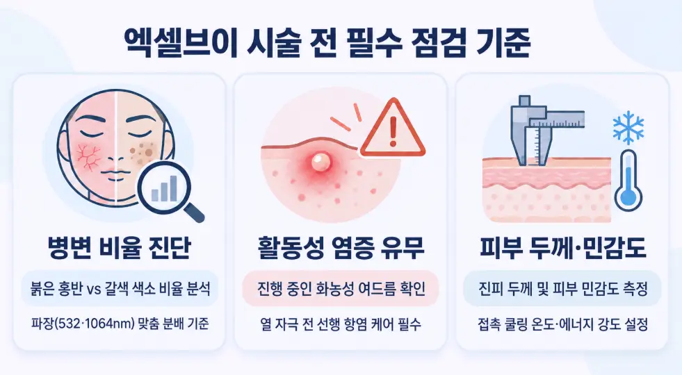 엑셀브이 시술 전 필수 점검 기준인 병변 비율 진단, 활동성 화농성 염증 유무 확인, 진피 두께 및 피부 민감도 측정 가이드
