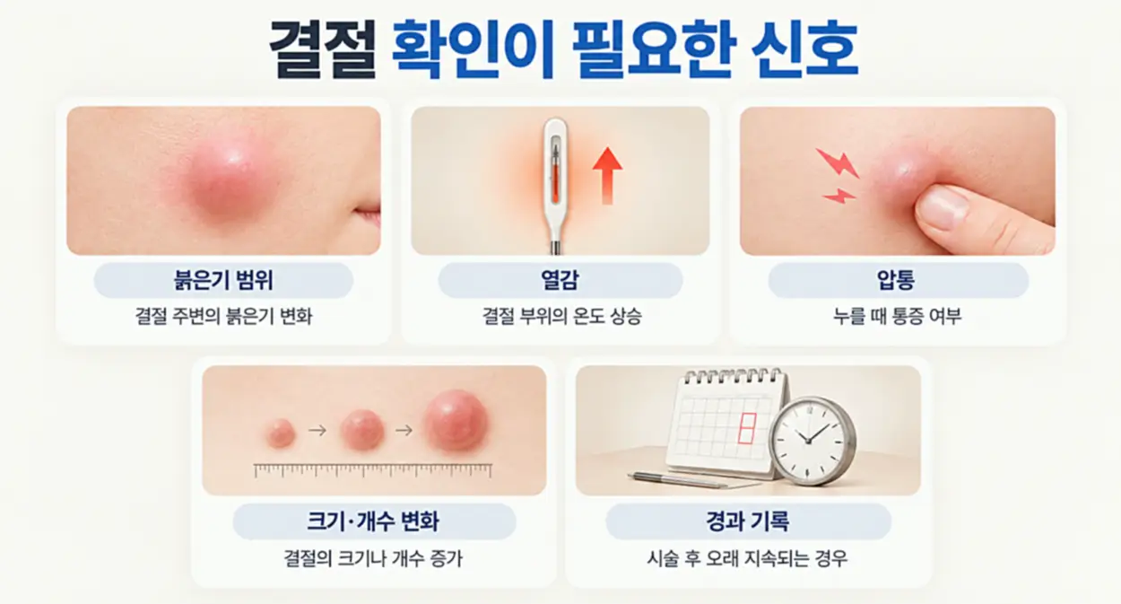 쥬베룩 볼륨 결절 발생 후 진료가 필요한 신호인 붉은기·열감·압통·크기 및 개수 변화·지속 기간을 나타낸 인포그래픽