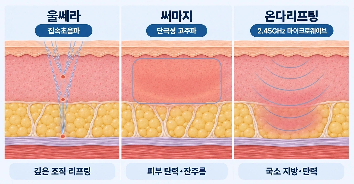 울쎄라·써마지·온다리프팅의 에너지 전달 방식과 피부층별 작용 범위를 비교한 의료 인포그래픽