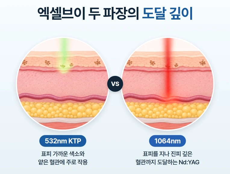 엑셀브이 레이저의 532nm KTP와 1064nm NdYAG 두 파장이 피부 표피와 진피에 도달하는 깊이 차이를 비교한 피부 단면 모식도