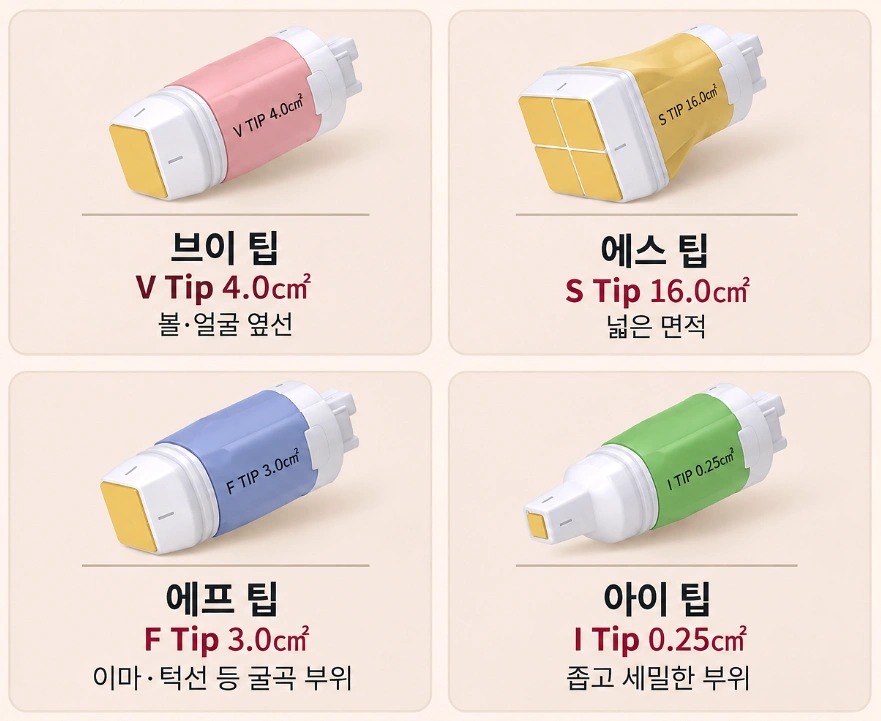 볼뉴머 V팁·S팁·F팁·I팁의 크기와 얼굴 및 시술 부위별 적용 범위를 비교한 팁 종류 이미지