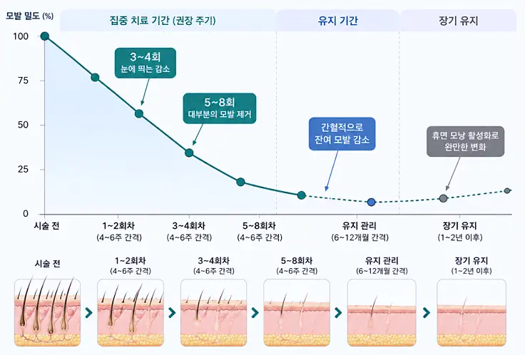 레이저 제모 시술 회차에 따른 영구 감모 밀도 감소 곡선 및 유지 변화 그래프