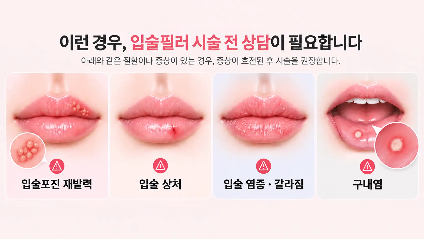 입술필러 시술 전 확인해야 할 사항