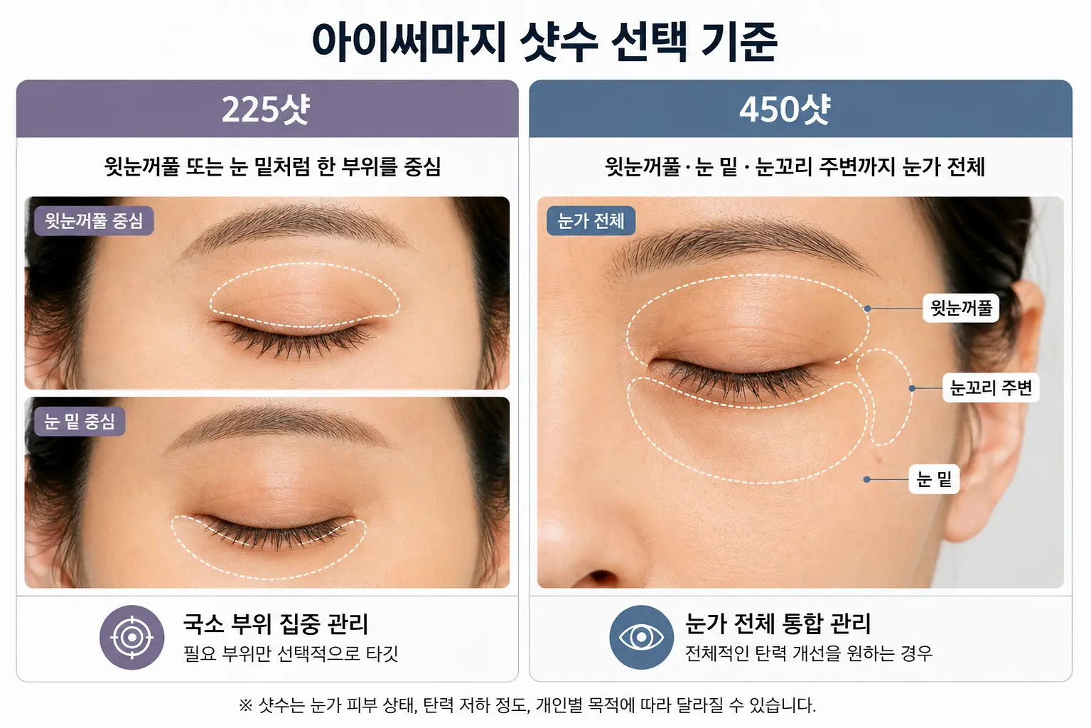 아이 써마지 225샷·450샷 적용 부위와 샷수 선택 기준