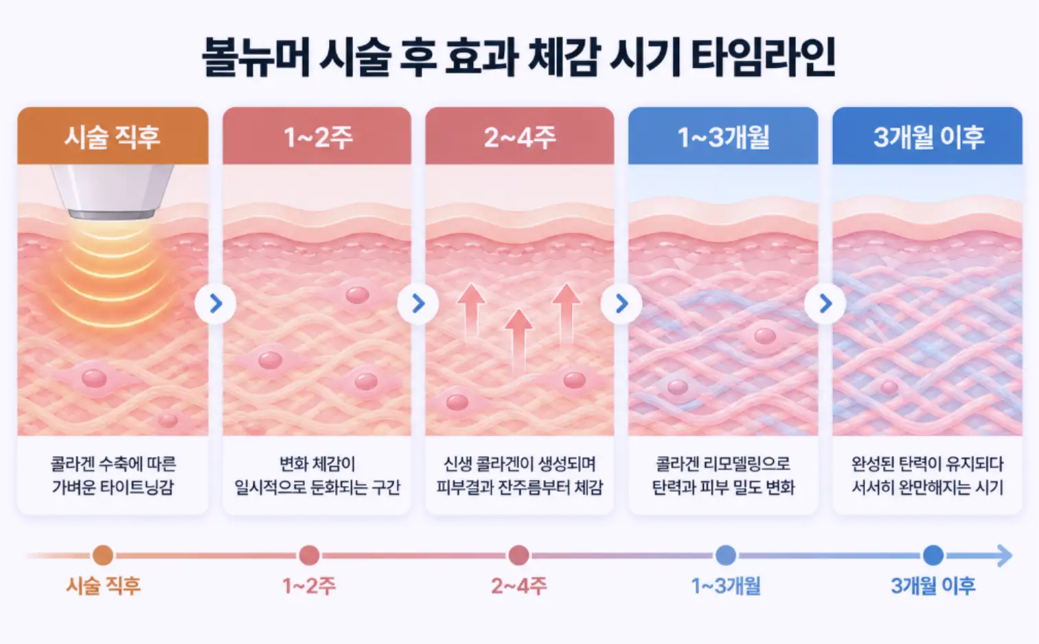 볼뉴머 시술 직후부터 1~3개월까지 시기별 효과 체감 타임라인
