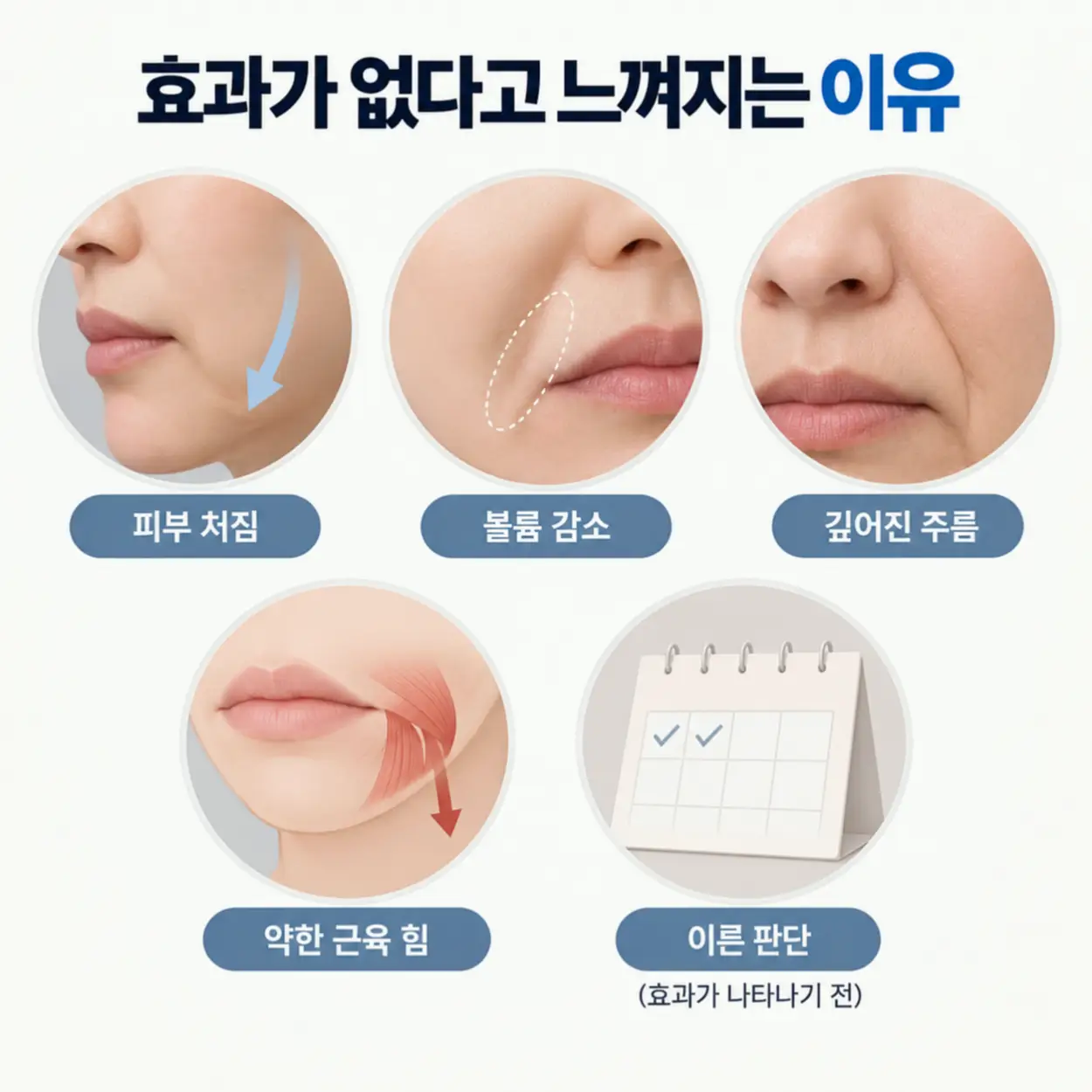 입꼬리보톡스 효과가 없다고 느껴지는 이유