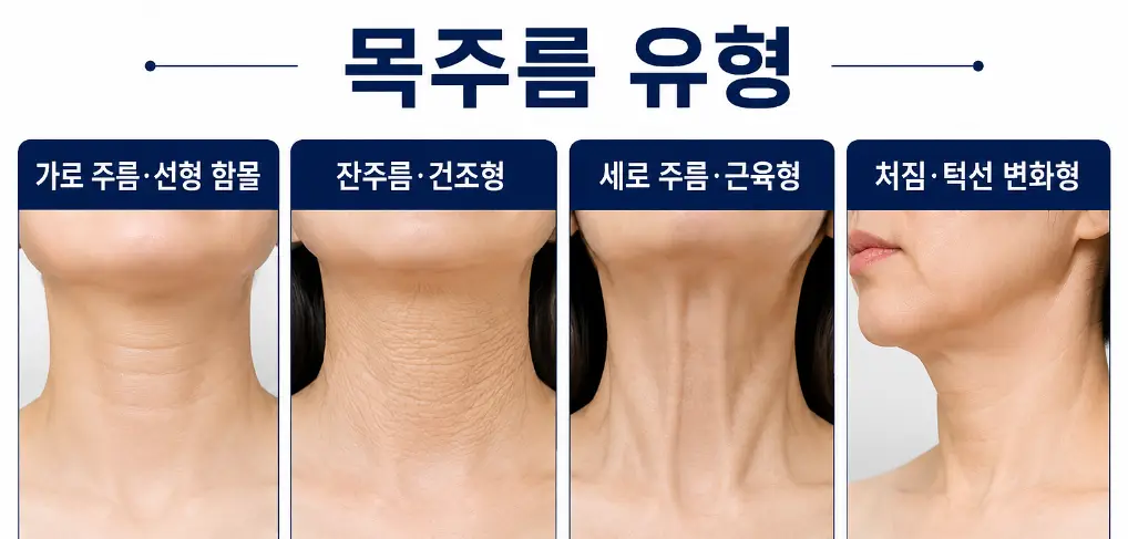 가로 주름·잔주름·세로 주름·처짐으로 구분하는 목주름 유형