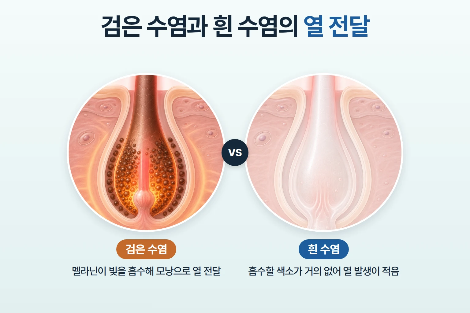 멜라닌이 많은 검은 수염 모근과 색소가 거의 없는 흰 수염 모근의 열 전달 차이를 비교한 모식도