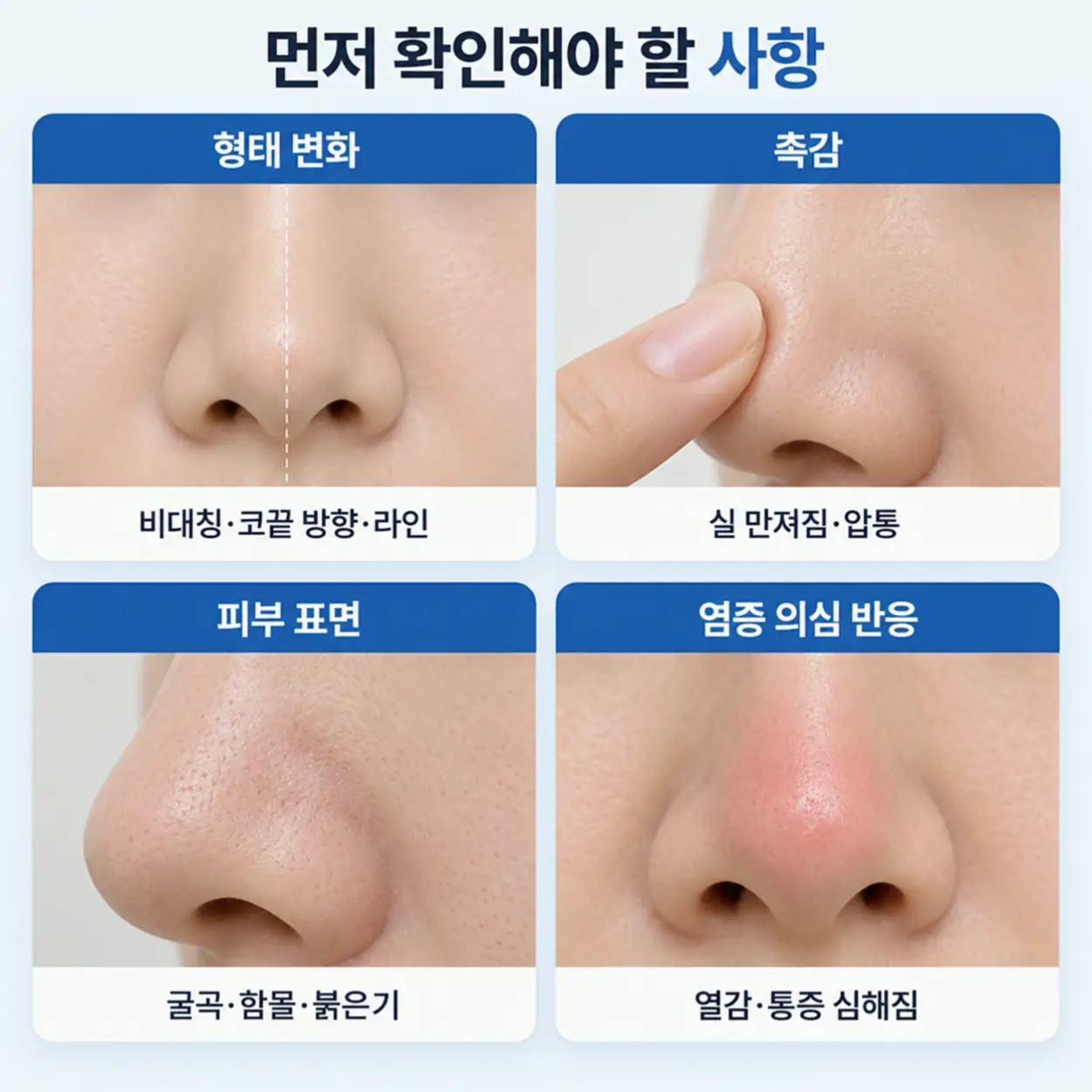 코 실 리프팅 후회한다면 확인해야 할 사항