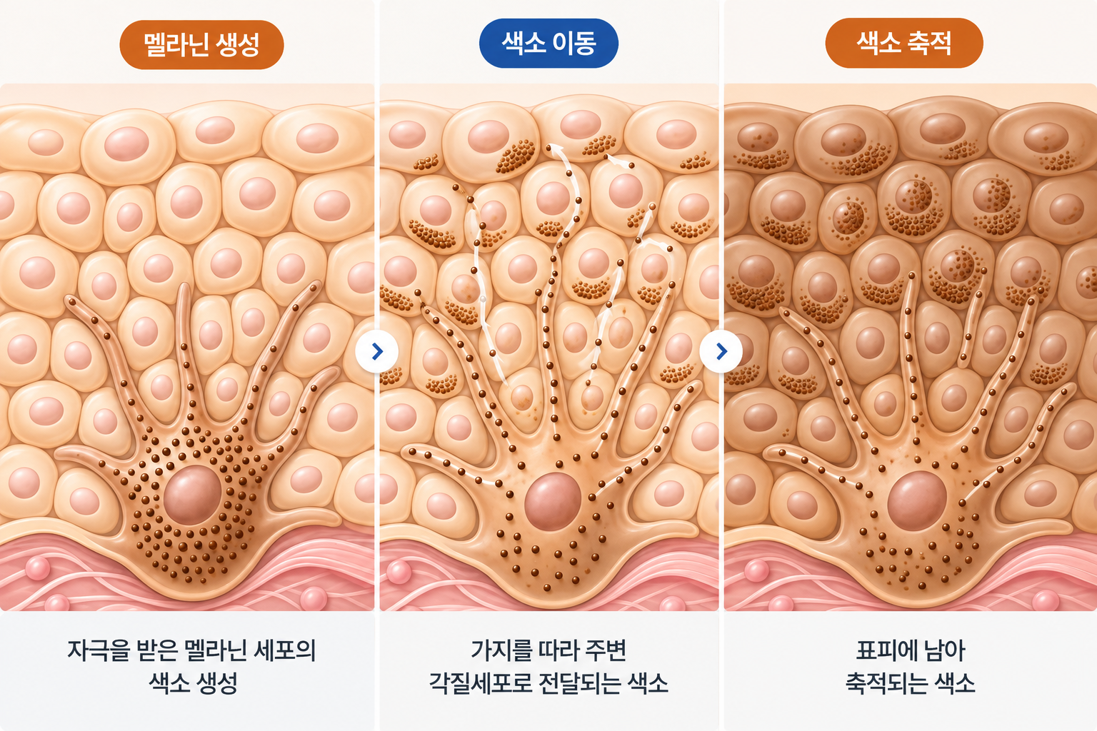 칙칙한 피부의 원인인 멜라닌이 멜라닌세포에서 생성되어 주변 각질세포로 이동하고 표피에 축적되는 과정