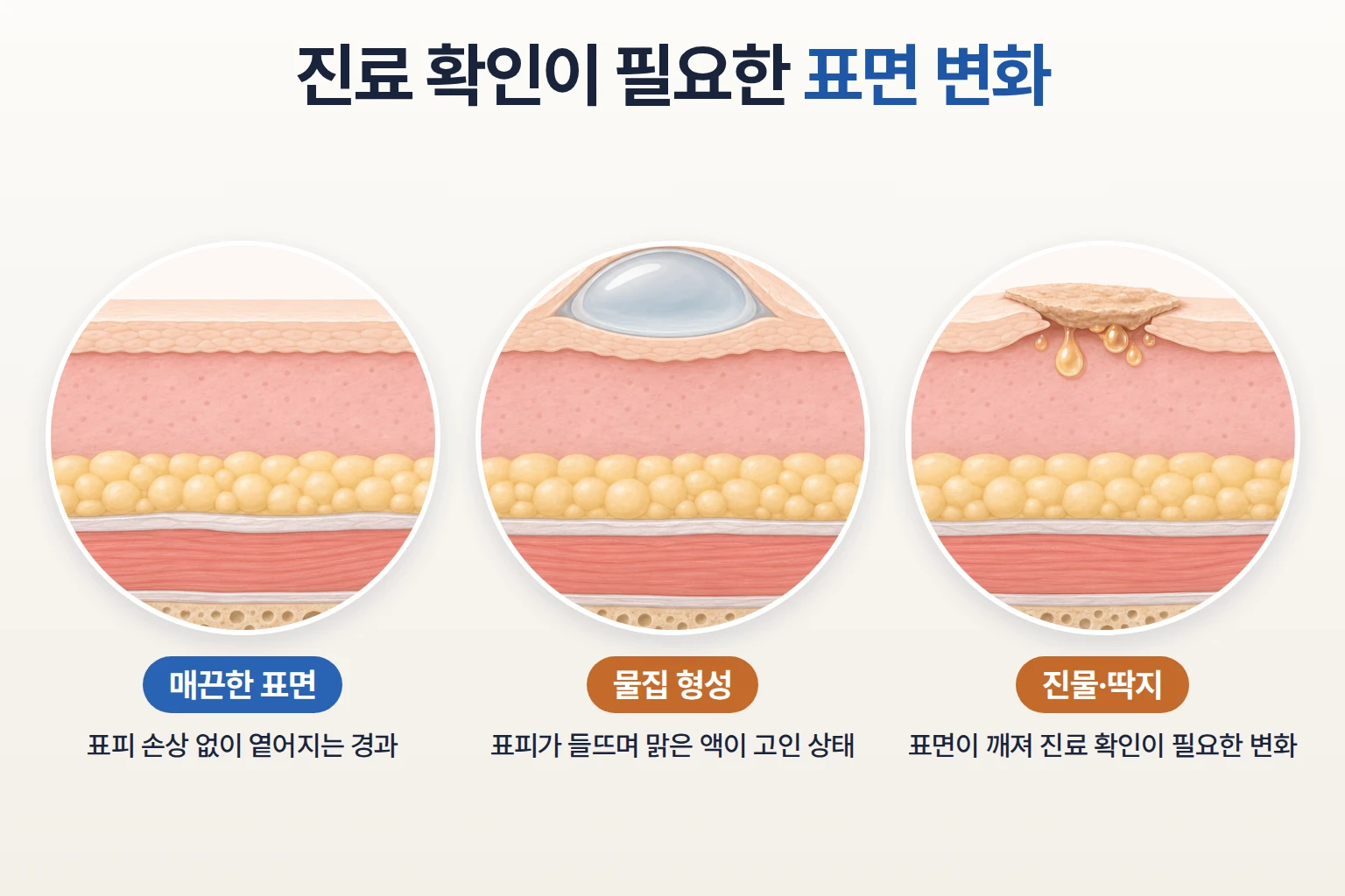 티타늄리프팅 후 바로 진료가 필요한 증상