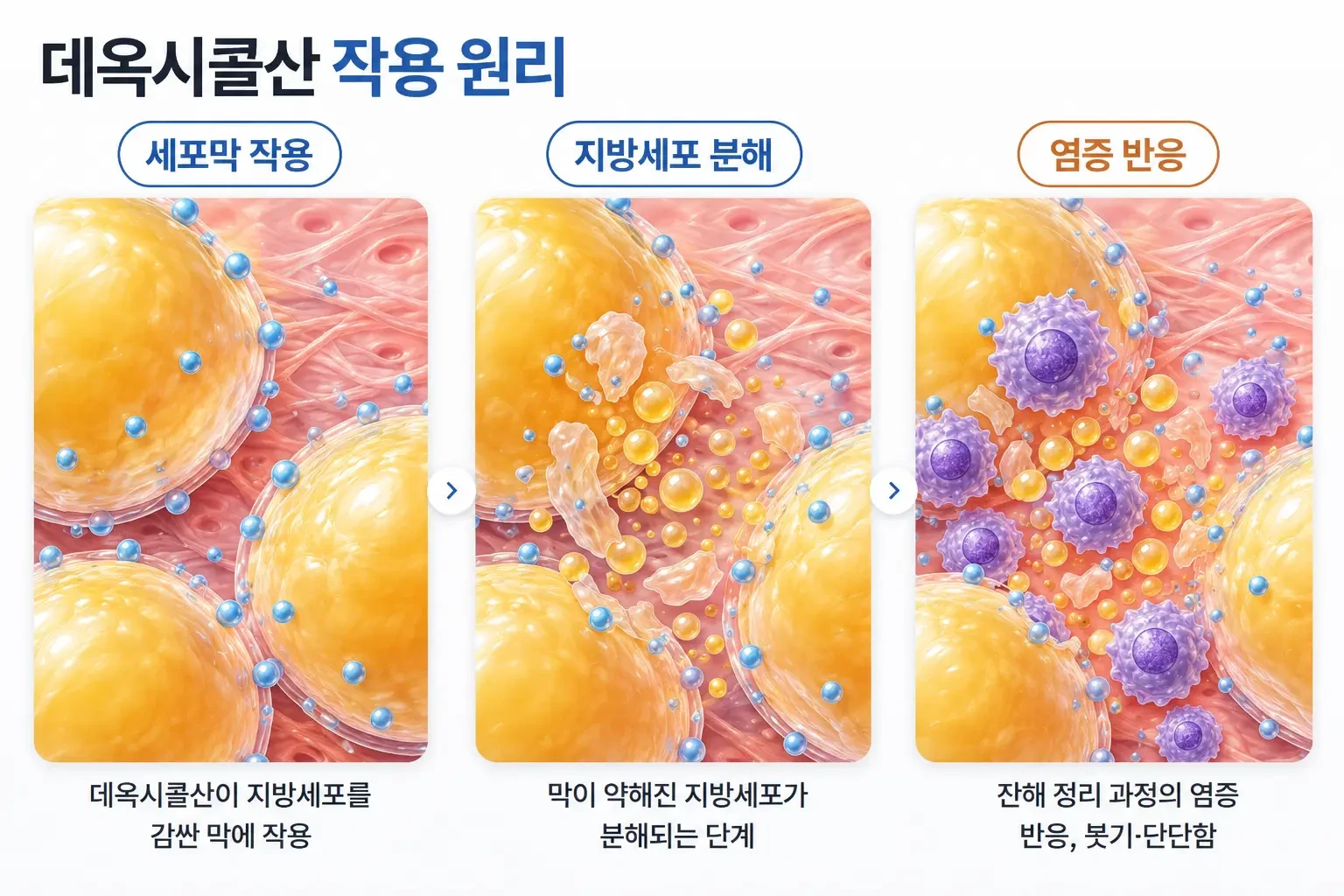 데옥시콜산이 지방세포막에 작용해 세포가 분해되고 주변에 염증 반응이 생기는 과정을 나타낸 개념도