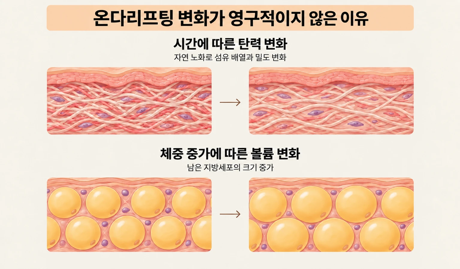 자연 노화에 따른 피부 탄력 변화와 체중 증가에 따른 지방세포 크기 변화