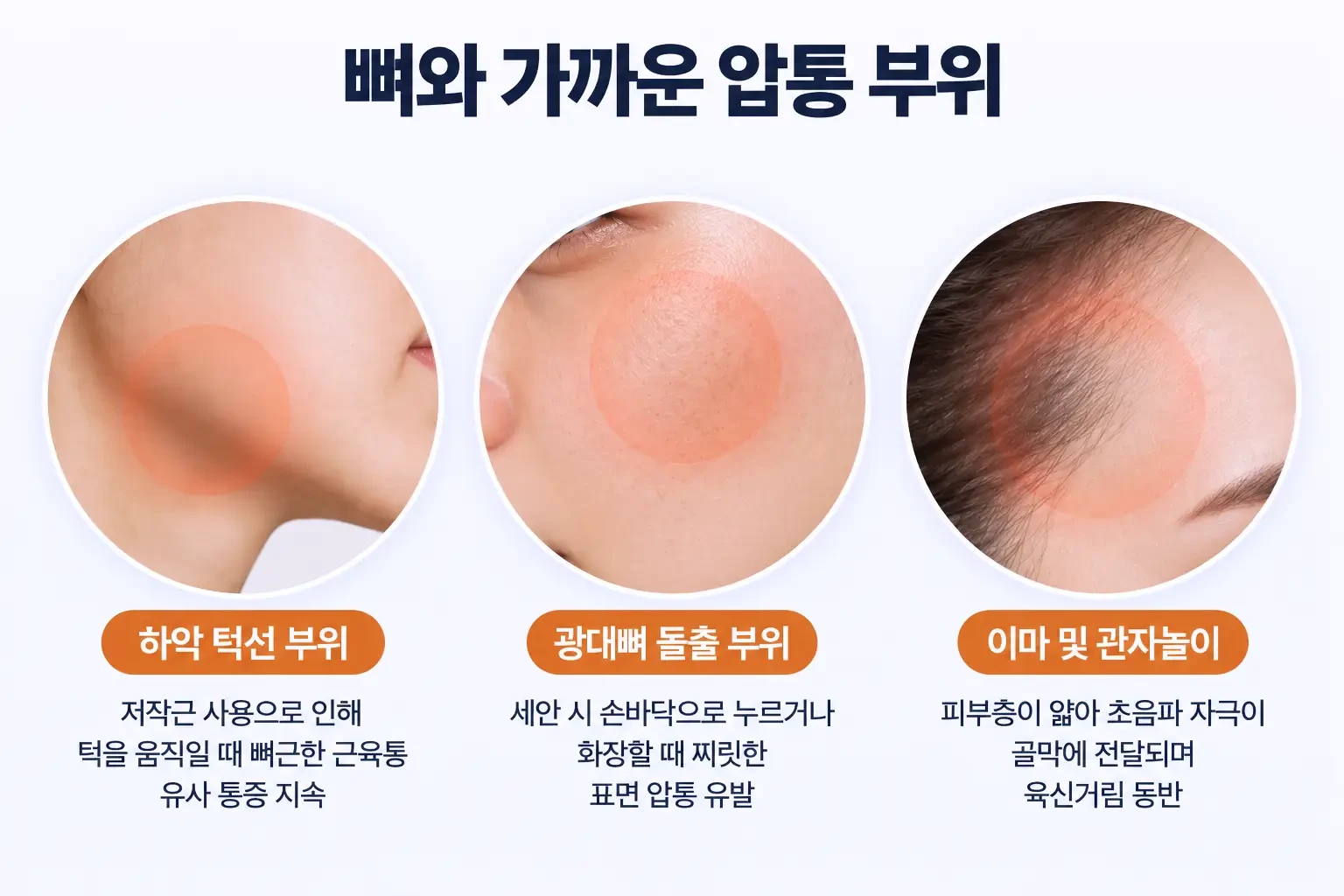 턱뼈 주변, 광대뼈 위, 관자놀이처럼 뼈와 가까워 압통이 남기 쉬운 부위를 나눠 보여 준 비교 사진