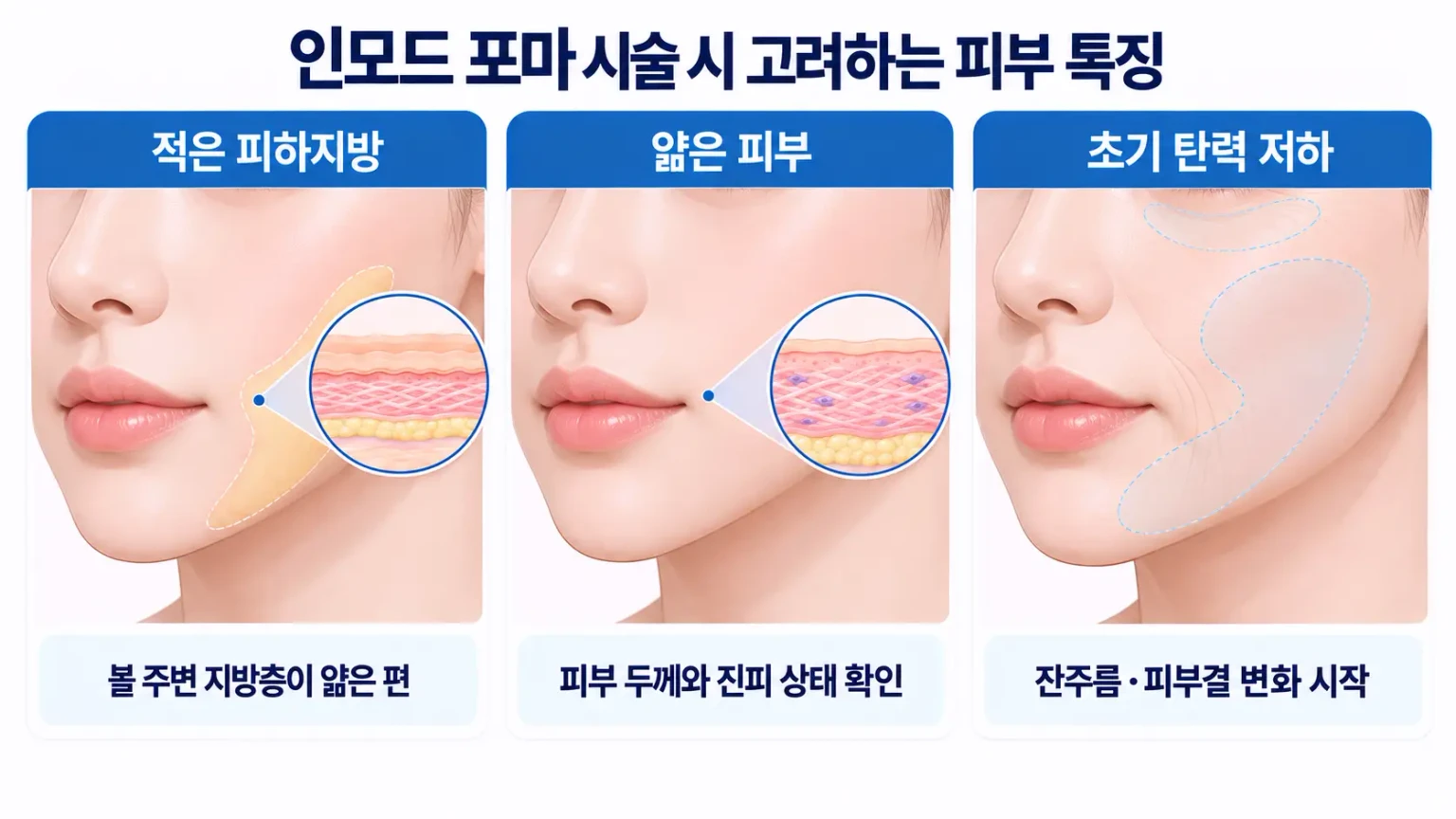 인모드 포마 시술 시 고려하는 피부 특징인 피하지방 분포, 얇은 피부, 초기 탄력
