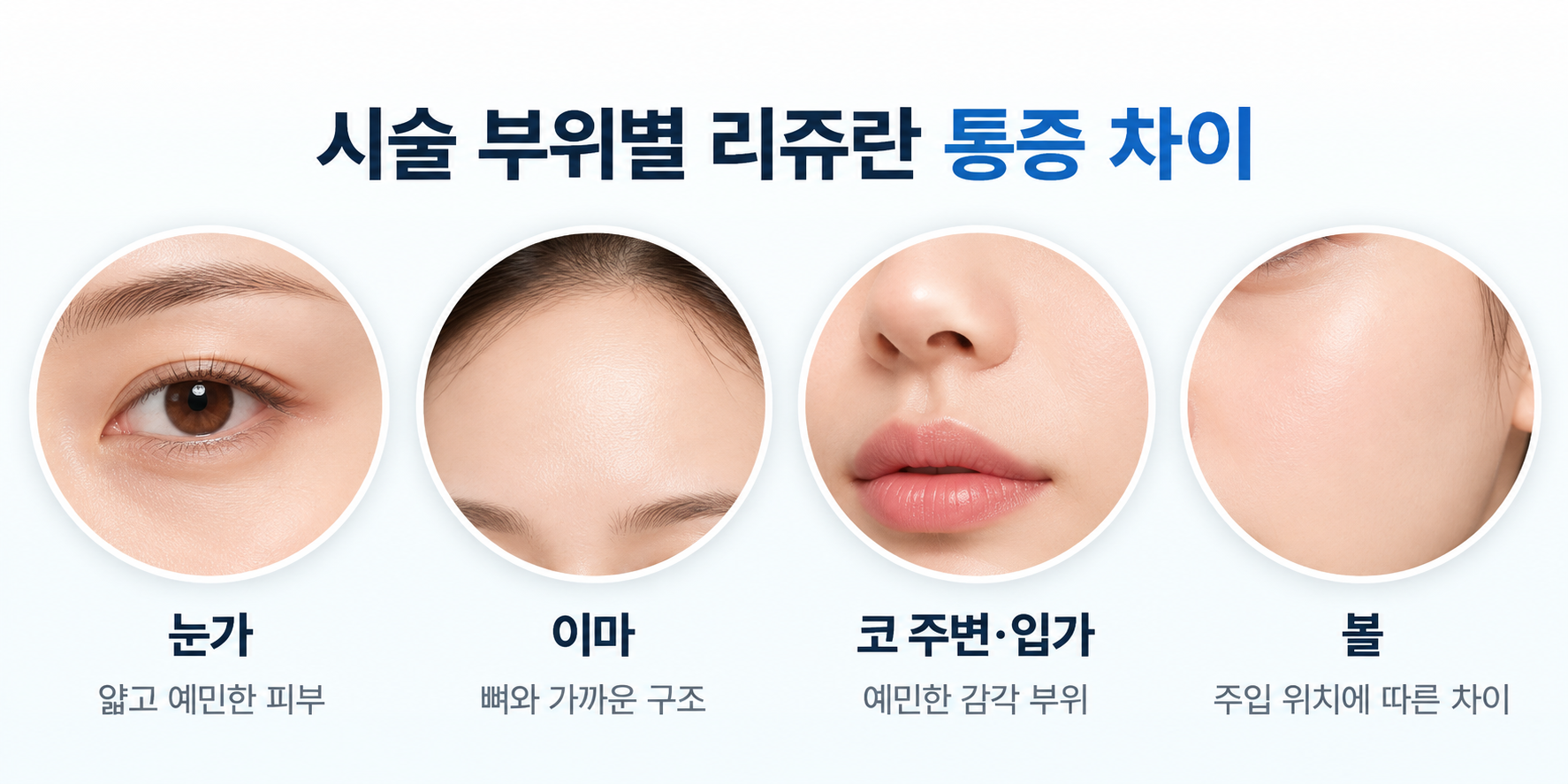 리쥬란 통증에 영향을 주는 눈가·이마·코 주변·입가·볼의 피부 부위별 민감도와 구조적 특징