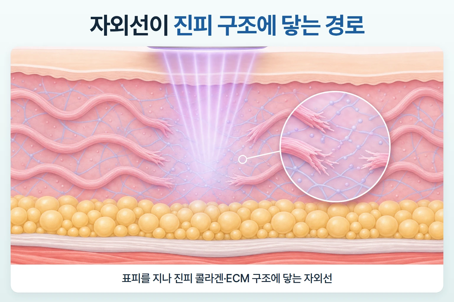 자외선이 표피를 지나 진피의 콜라겐과 세포외기질 구조에 닿는 경로를 나타낸 에너지 도달 일러스트