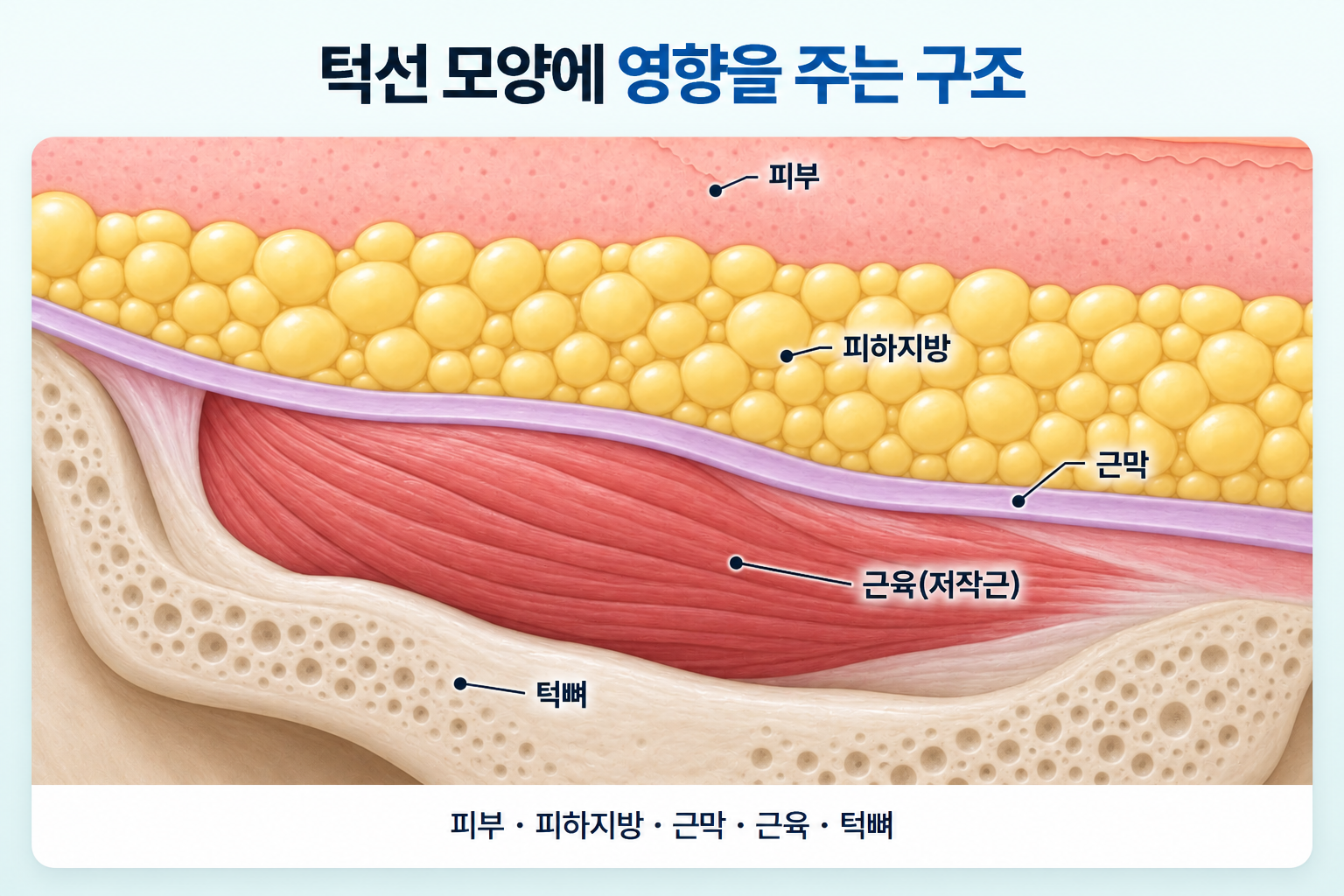 턱선 모양에 영향을 주는 피부, 피하지방, 근막, 저작근과 턱뼈의 위치 및 하관 조직 구조