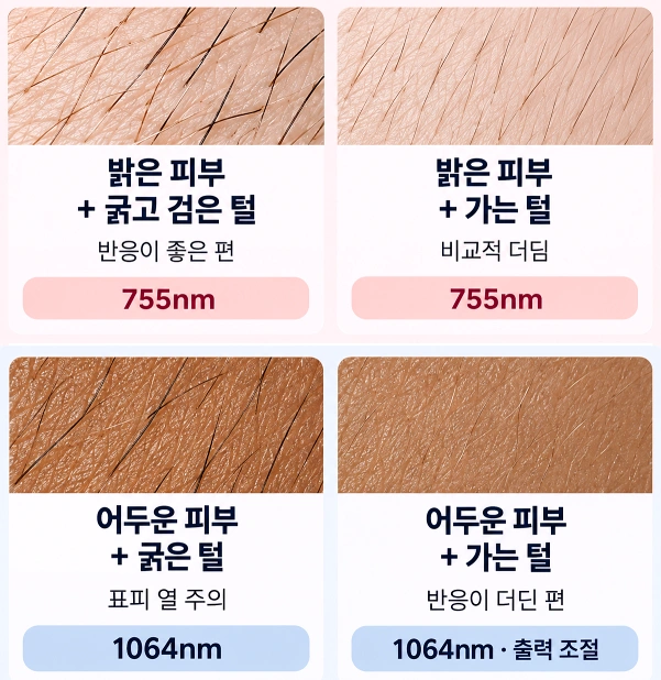 밝은 피부와 어두운 피부에서 굵은 털·가는 털의 특성에 따라 755nm와 1064nm 레이저 적용을 구분한 제모 파장 선택 비교 이미지