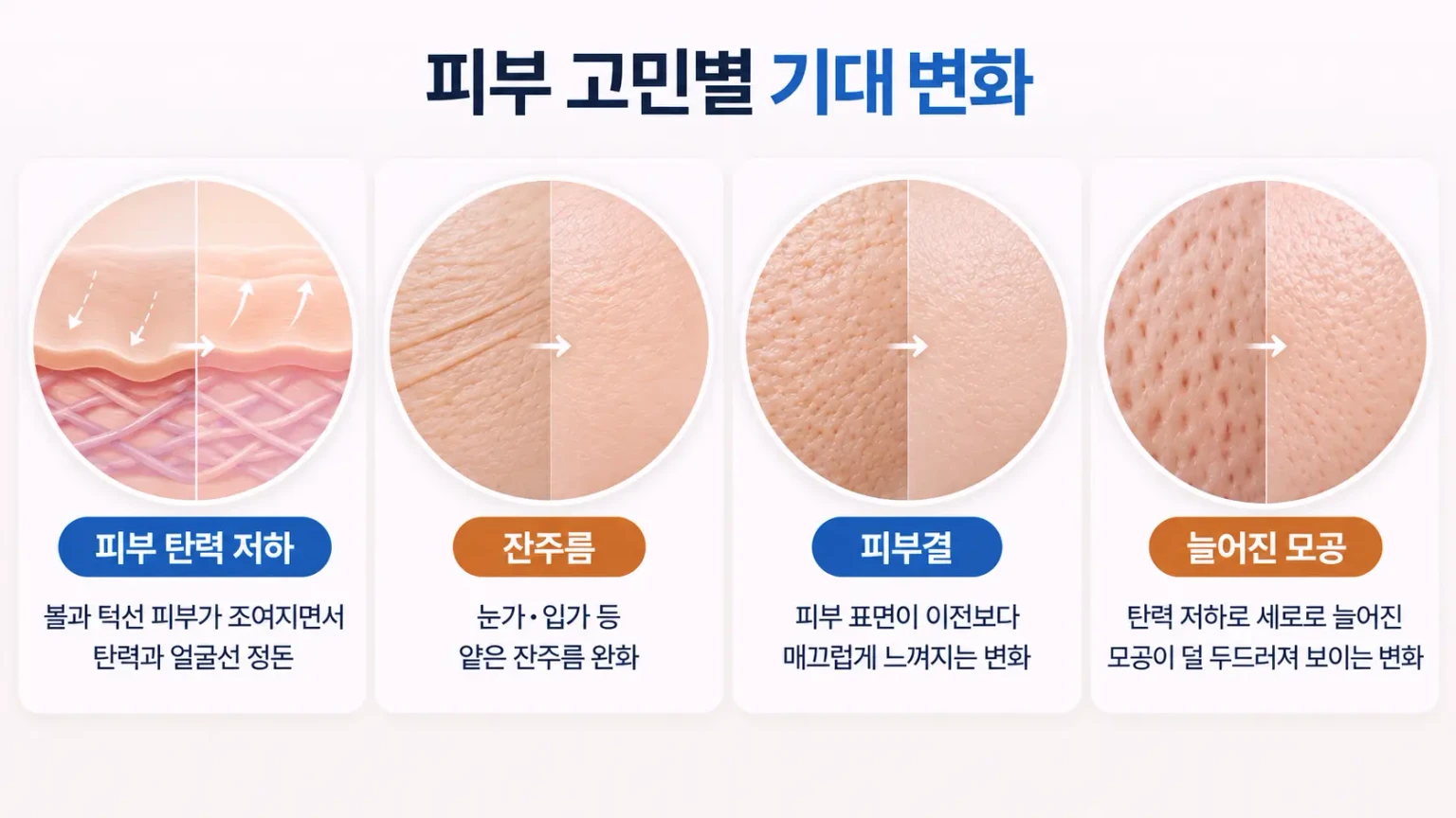 탄력이 떨어진 피부의 거친 결, 잔주름, 세로로 늘어진 모공을 같은 배율로 비교한 피부 표면 사진