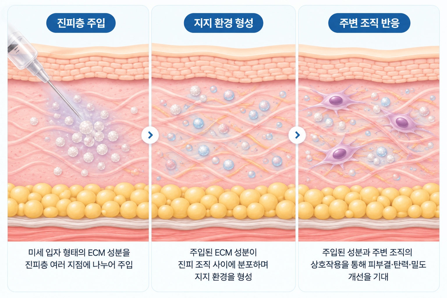 엘라비에 리투오 ECM 미세 입자의 진피층 주입, 조직 사이 분포, 주변 섬유아세포와의 상호작용을 통한 피부 개선 원리