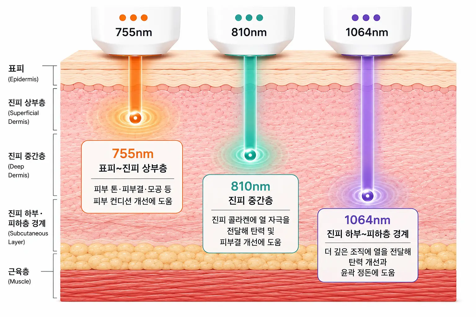 세 가지 파장이 서로 다른 피부 깊이에 전달되어 나타나는 티타늄리프팅 효과