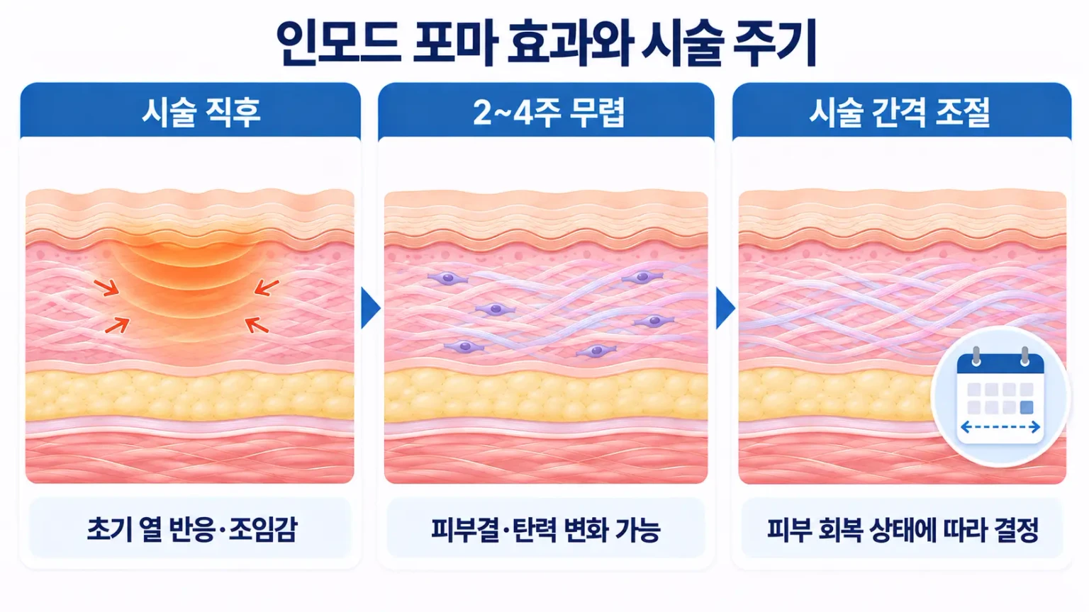 인모드 포마 효과와 시술 주기를 초기 열 반응, 피부결·탄력 변화, 피부 회복 상태에 따라