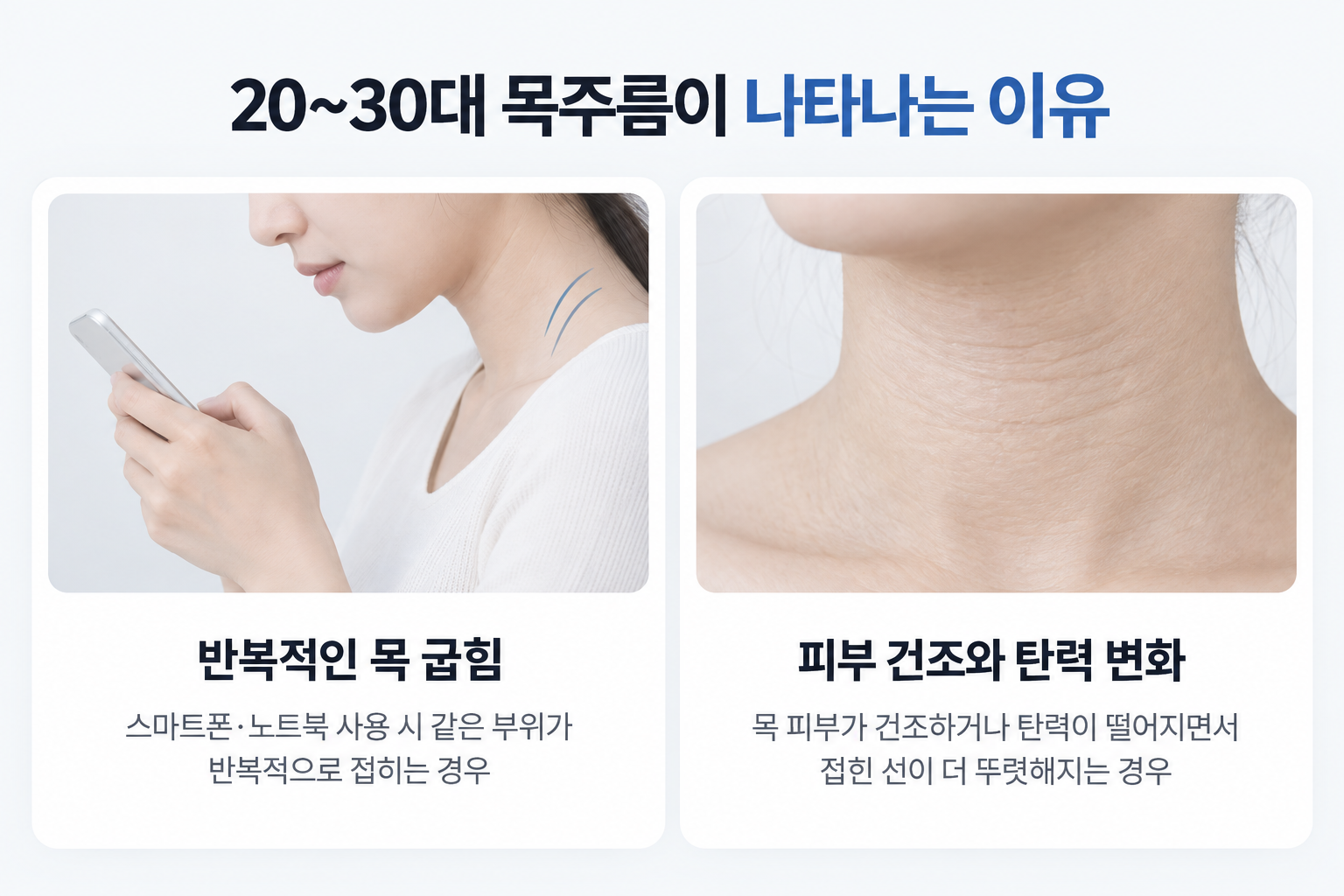 20~30대에서 반복적인 목 굽힘과 피부 건조 탄력 변화로 나타나는 목주름