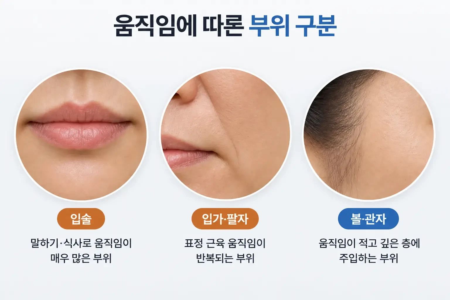 입술, 입가·팔자처럼 움직임이 많은 부위와 볼·관자처럼 적은 부위를 나눠 보여준 비교 사진