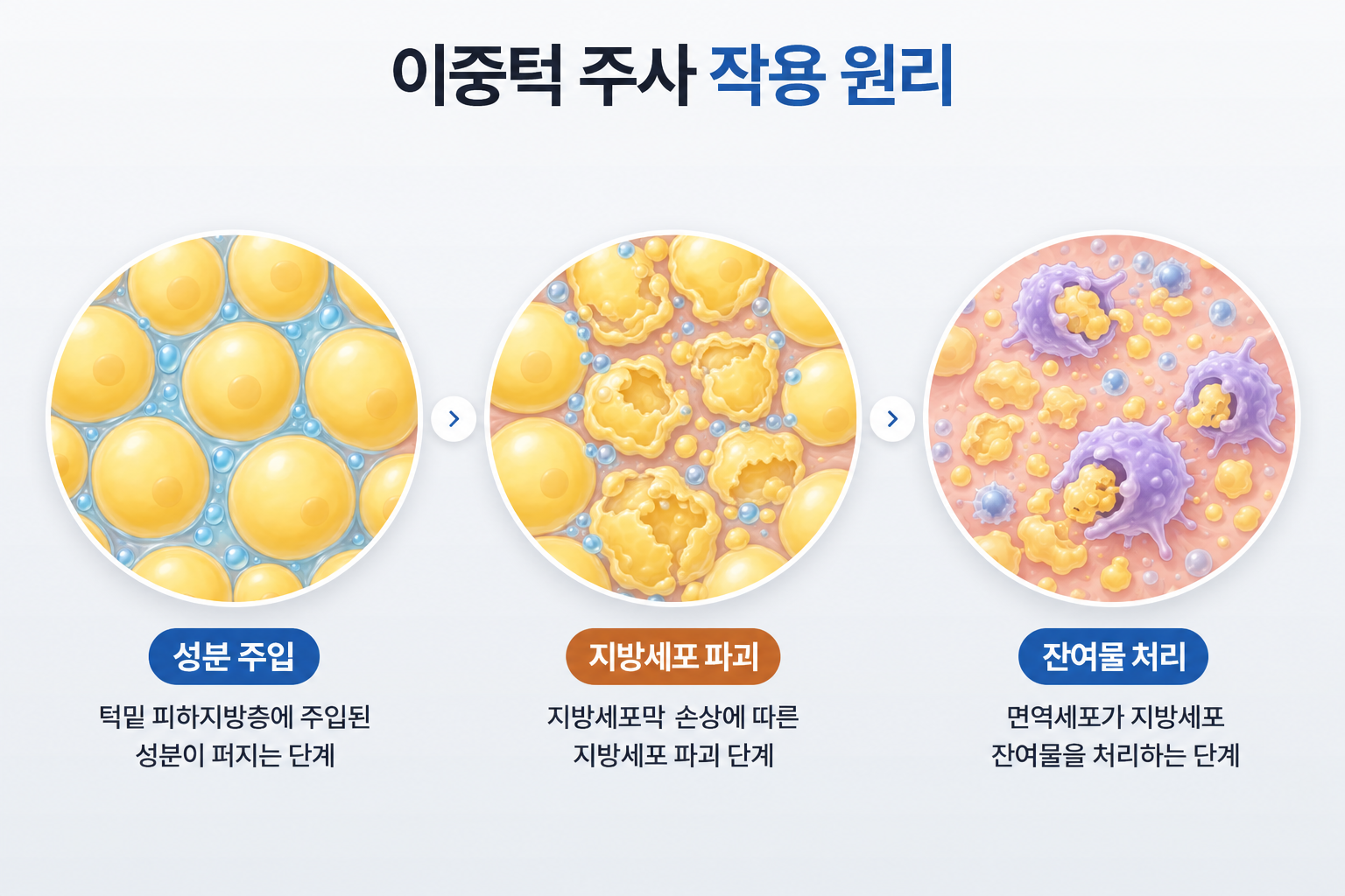 이중턱 주사의 성분 주입부터 지방세포 파괴와 면역세포의 잔여물 처리 과정
