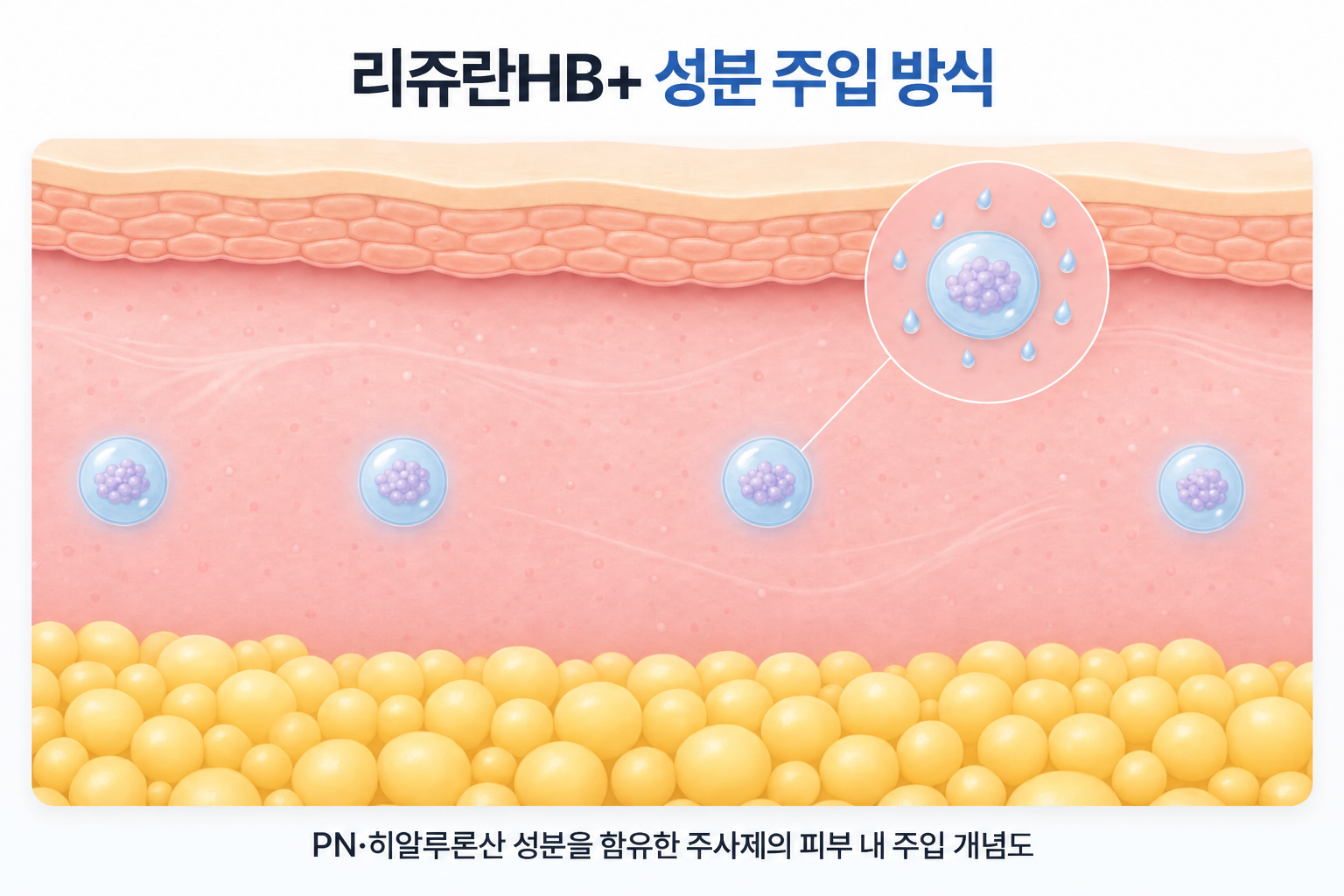 리쥬란HB+ 피부주사에 포함된 PN과 히알루론산 성분이 피부 조직 내 여러 지점에 분포하는 주입 개념도