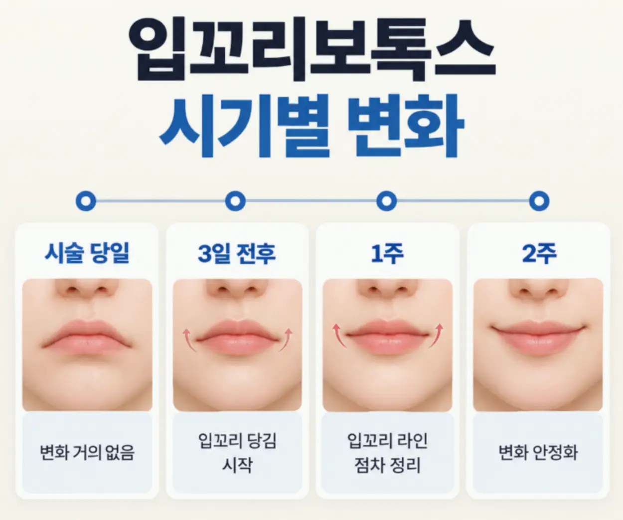 입꼬리보톡스 효과 나타나는 시기
