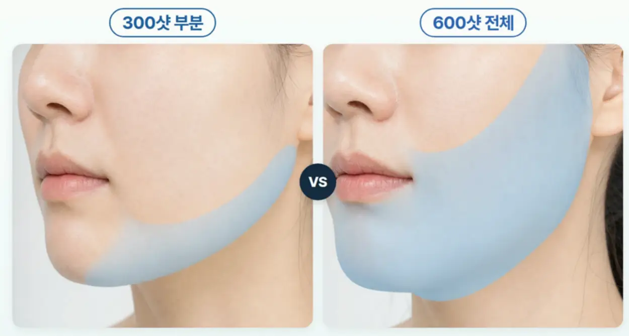 볼뉴머 샷수가 전후 변화에 영향을 주는 이유