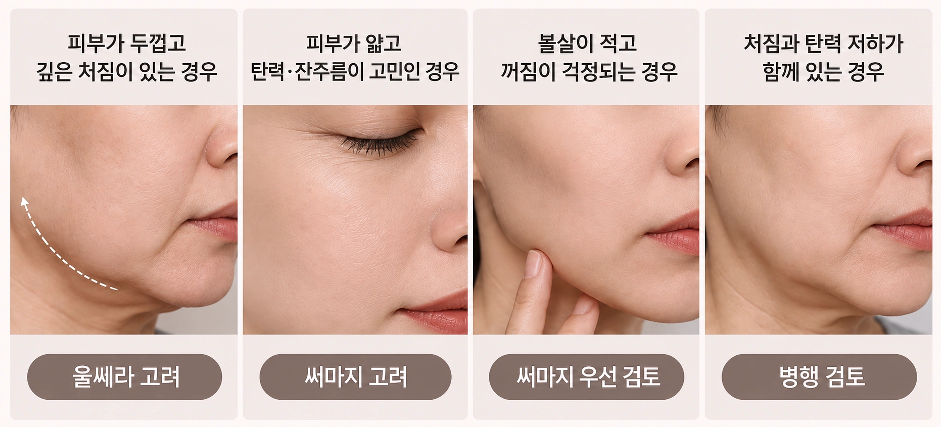 피부 두께와 처짐 정도, 볼살과 탄력 상태에 따른 울쎄라·써마지 적용 기준을 정리한 비교 인포그래픽