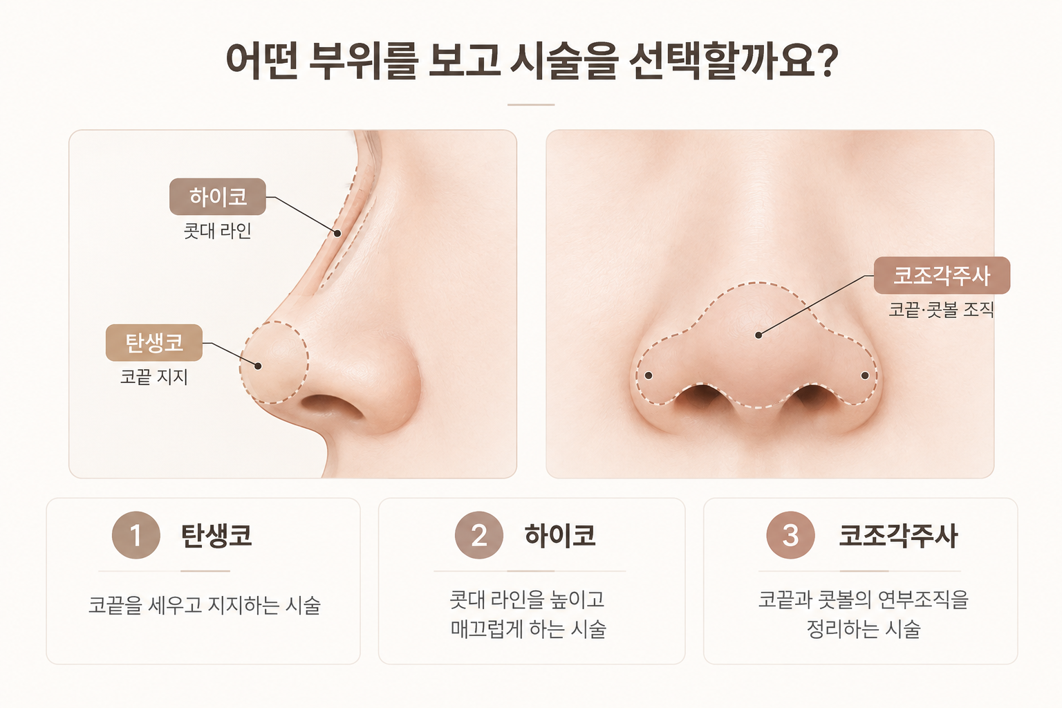 코끝 높이기 탄생코 코끝 하이코 콧대 코조각주사 코끝 콧볼 적용 부위