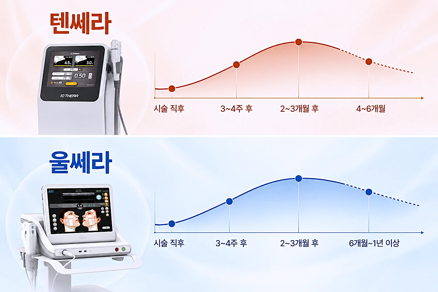 텐쎄라와 울쎄라 효과 체감 시기와 유지기간 비교 인포그래픽 