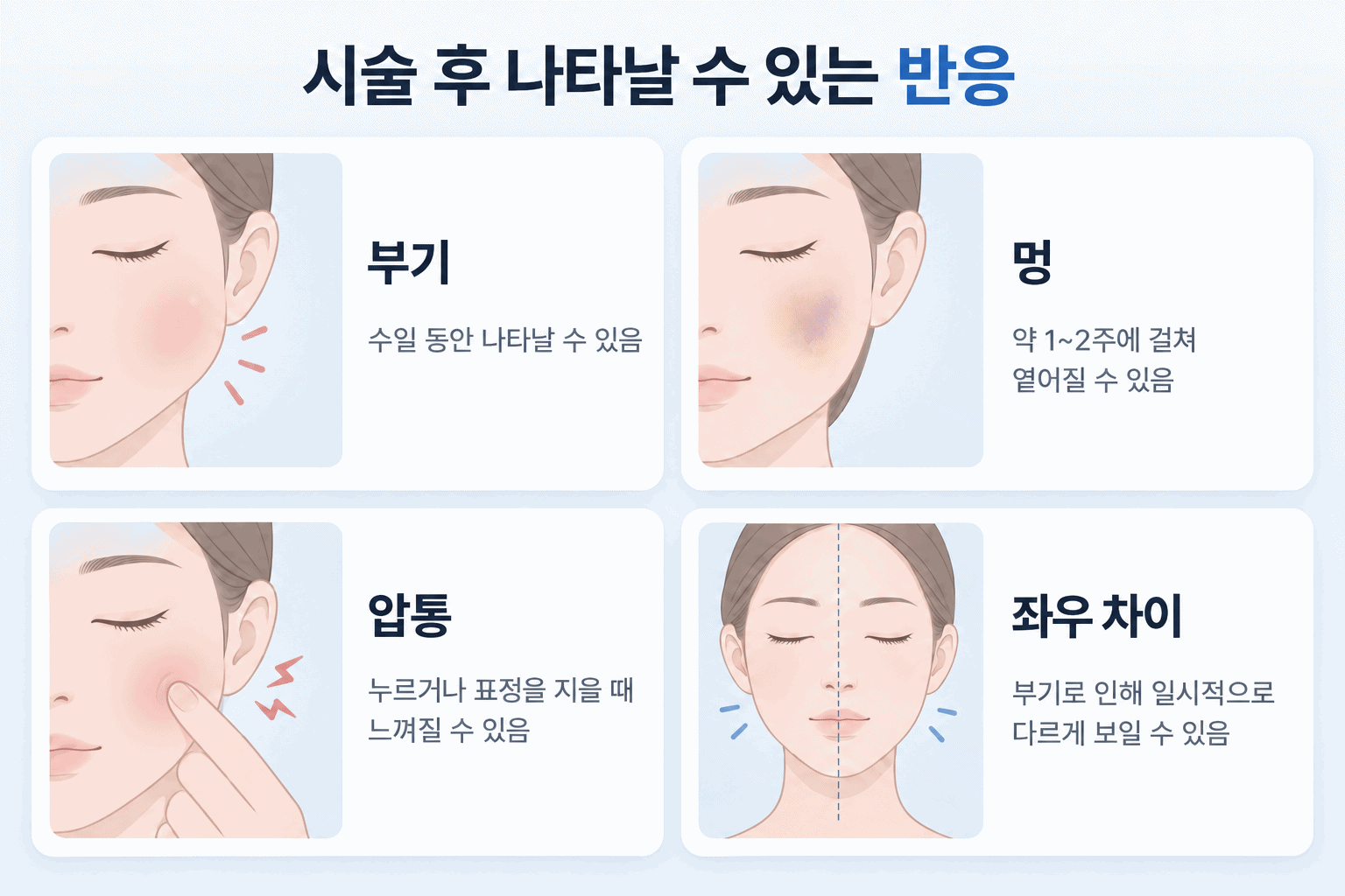 앞광대 주입 시술 후 나타날 수 있는 부기 멍 압통 좌우 차이
