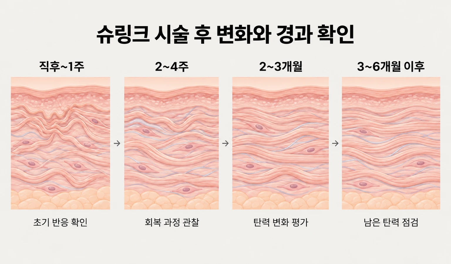 슈링크 직후부터 수개월 이후까지의 피부 변화와 경과 확인 단계