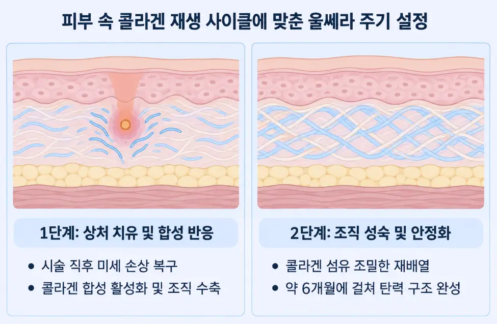 상처 치유 및 콜라겐 합성 반응과 6개월에 걸친 조직 성숙 과정을 설명하는 피부 속 울쎄라 재생 사이클 2D 단면 모식도